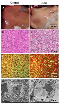 Effects of High-Fat Diet on Steatosis, Endoplasmic Reticulum Stress and Autophagy in Liver of Tilapia (Oreochromis niloticus)